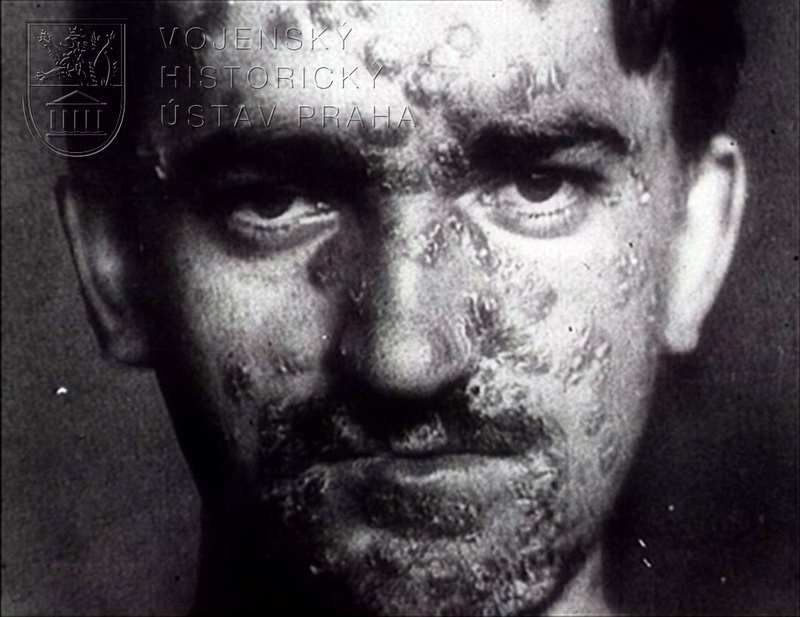 Film „Pohlavní choroby“